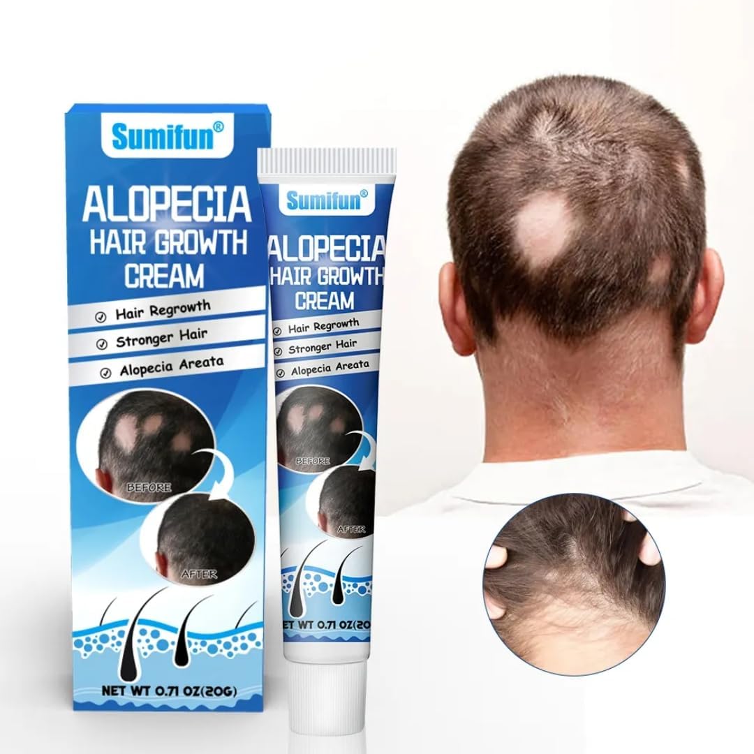NIKITA.VIVI Hair Growth Cream, Alopecia Hair Growth Cream, Hair Regrowth Treatment Cream, Promoting Hair Growth & Effective Treatment for Alopecia & Thinning Hair 20G