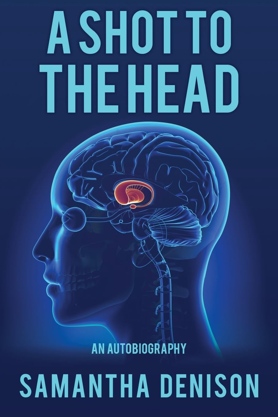 A Shot To The Head