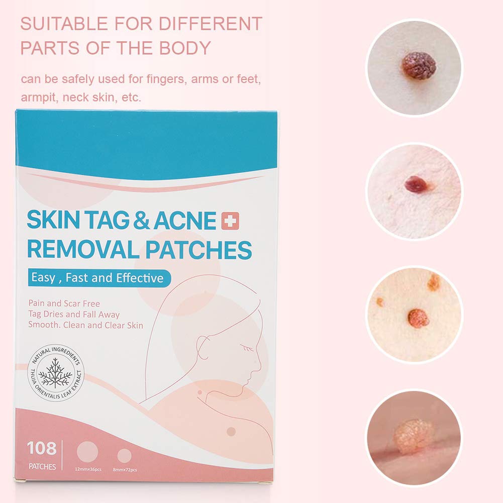 Skin Tag, Removal Stickers, Skin Tag Removal Patch Wart Removal