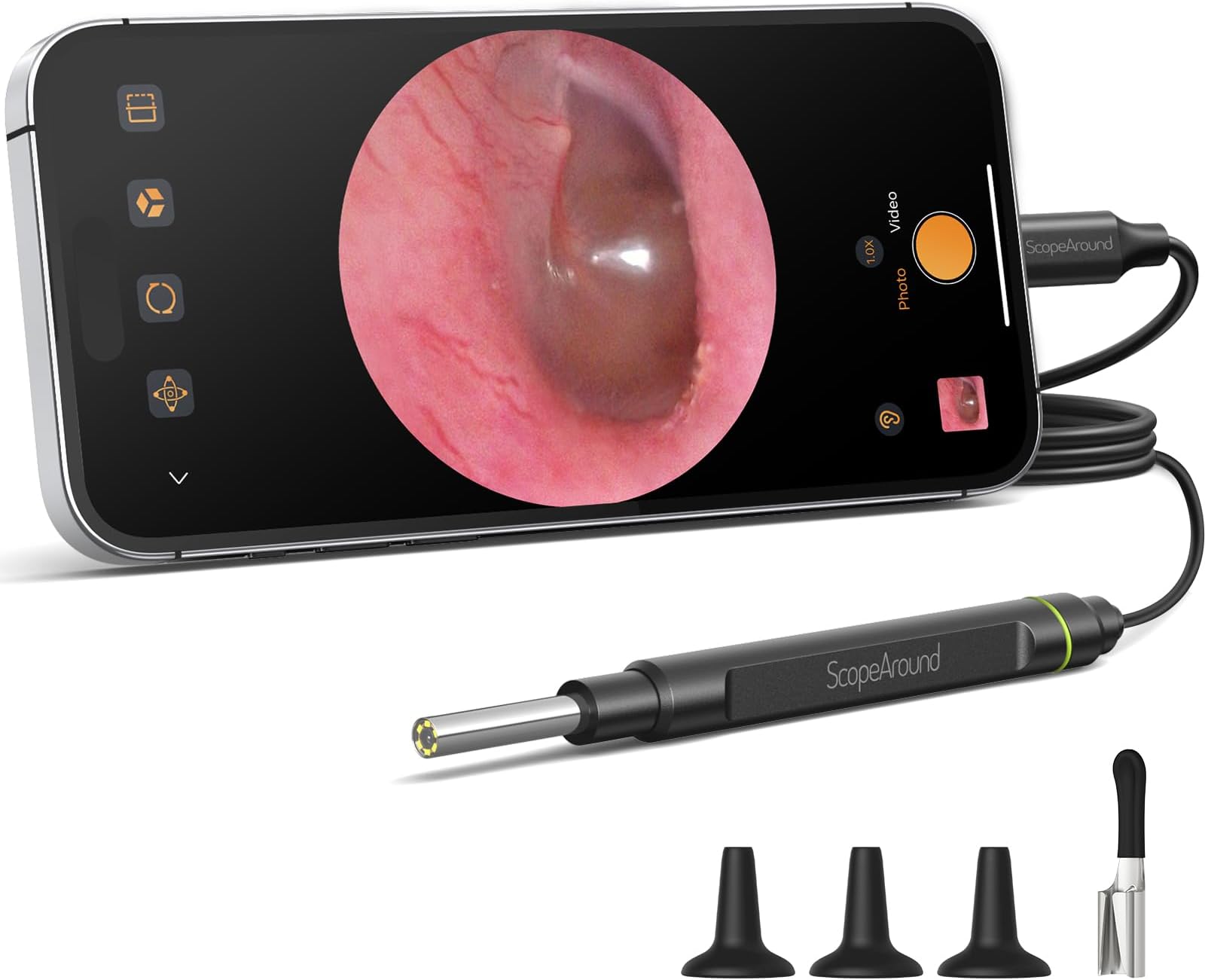 ScopeAround Otoscope with Light, 1080P FHD Ear Scope, 3.9mm Digital Otoscope Camera with 6 LED Lights Ear Wax Removal Tool Camera, Ear Scope with Light, Compatible with USB-C