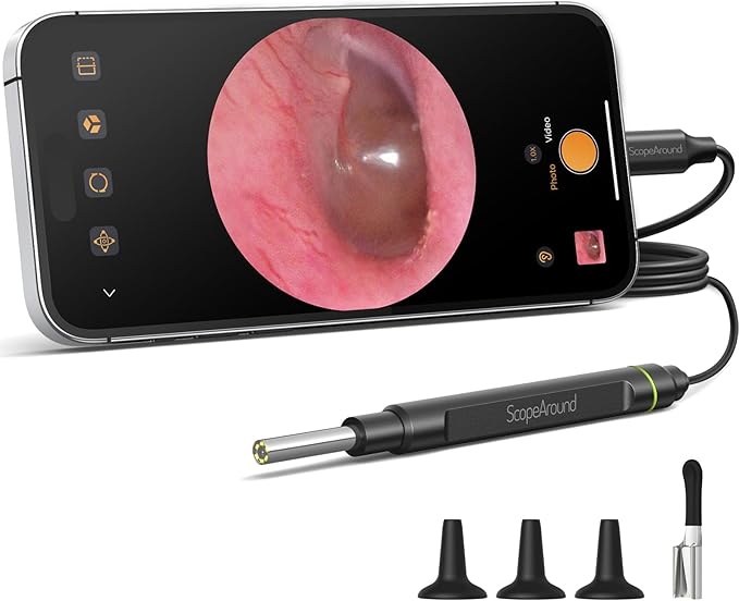 ScopeAround Otoscope with Light, 1080P FHD Ear Scope, 3.9mm Digital Otoscope Camera with 6 LED Lights Ear Wax Removal Tool Camera, Ear Scope with Light, Compatible with iPhone15 & Android