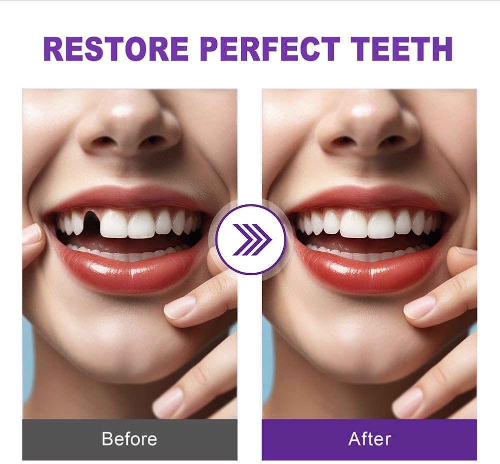 Tooth Provisional Kit