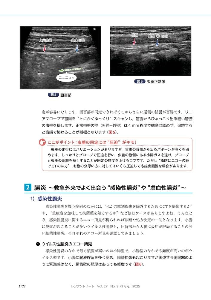 レジデントノート 2025年9月 Vol.27 No.9 救急エコー 素早く確実