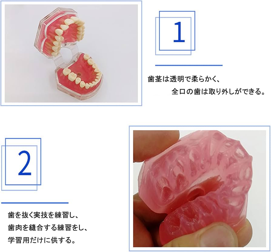 Amazon.co.jp: 歯列模型 歯が抜く説明モデル 歯科インプラント