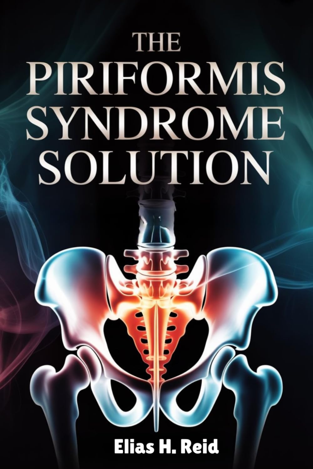 THE PIRIFORMIS SYNDROME SOLUTION: Relieve Sciatic Nerve Pain, Unlock Tight Hips, and Eliminate Chronic Glute Pain Naturally