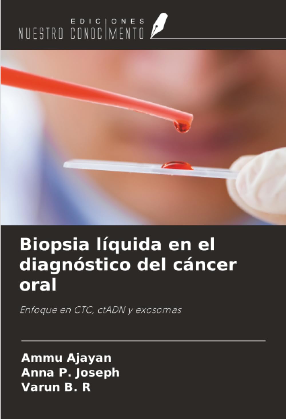 Biopsia líquida en el diagnóstico del cáncer oral: Enfoque en CTC, ctADN y exosomas