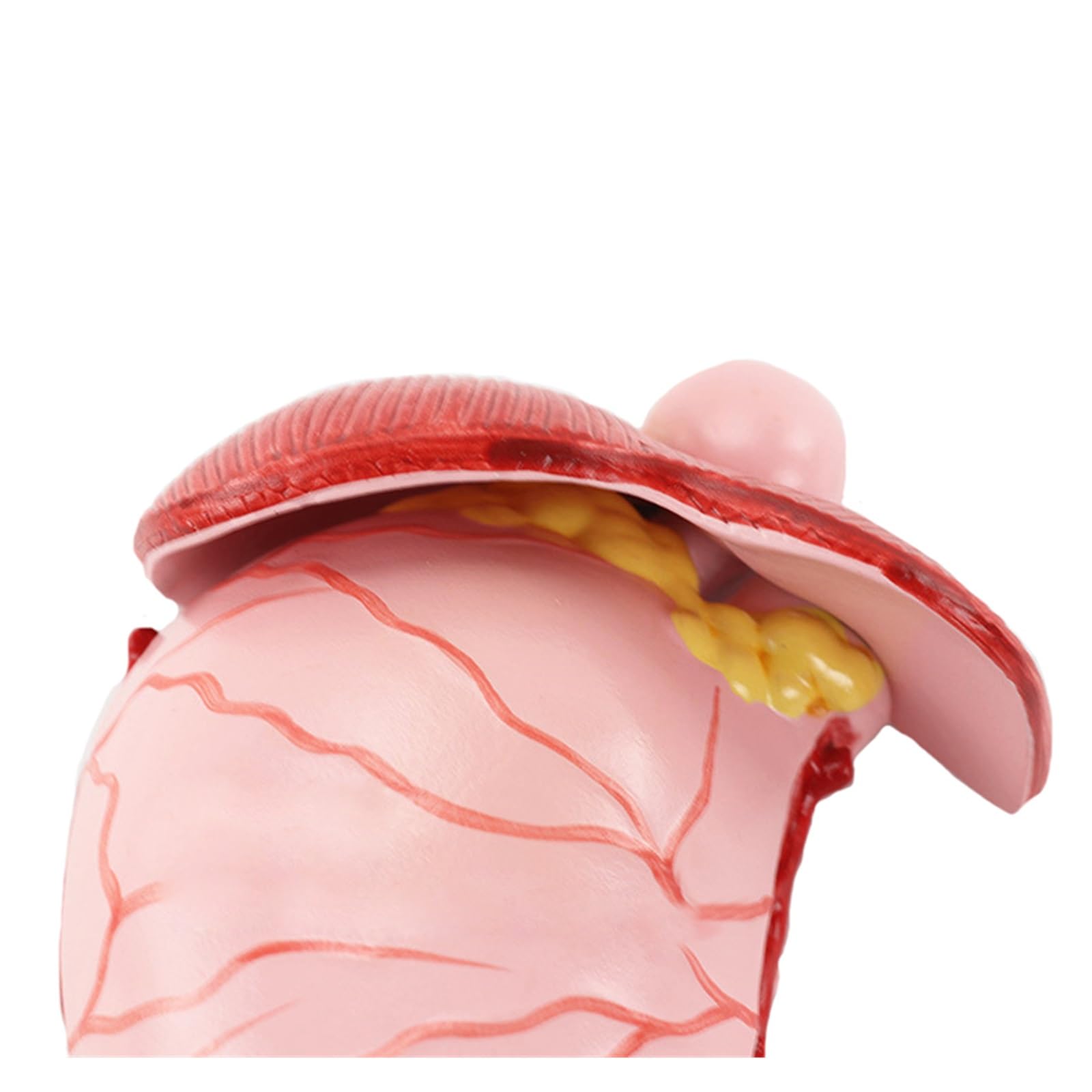 Humano EN Anatomía estomacal patológica Modelo de demostración del estómago Ayuda médica SIDA