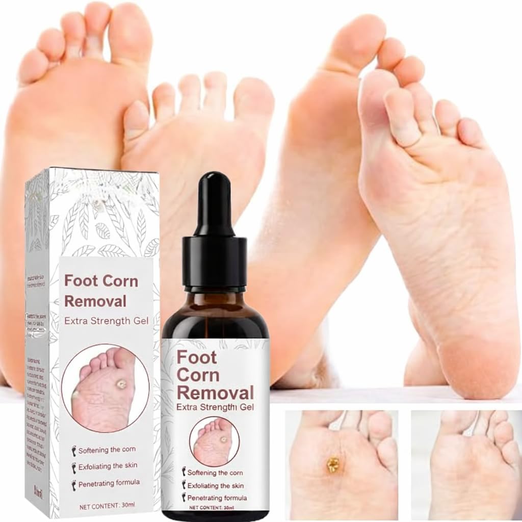 Advanced Foot Corn Removal Gel | Fast-Acting Treatment for Corns, Calluses, Hard Skin & Cracked Heels | Deep Exfoliating Foot Care Formula for Smooth, Soft & Healthy Feet (30 ml, Aloe Vera, pack of 1)