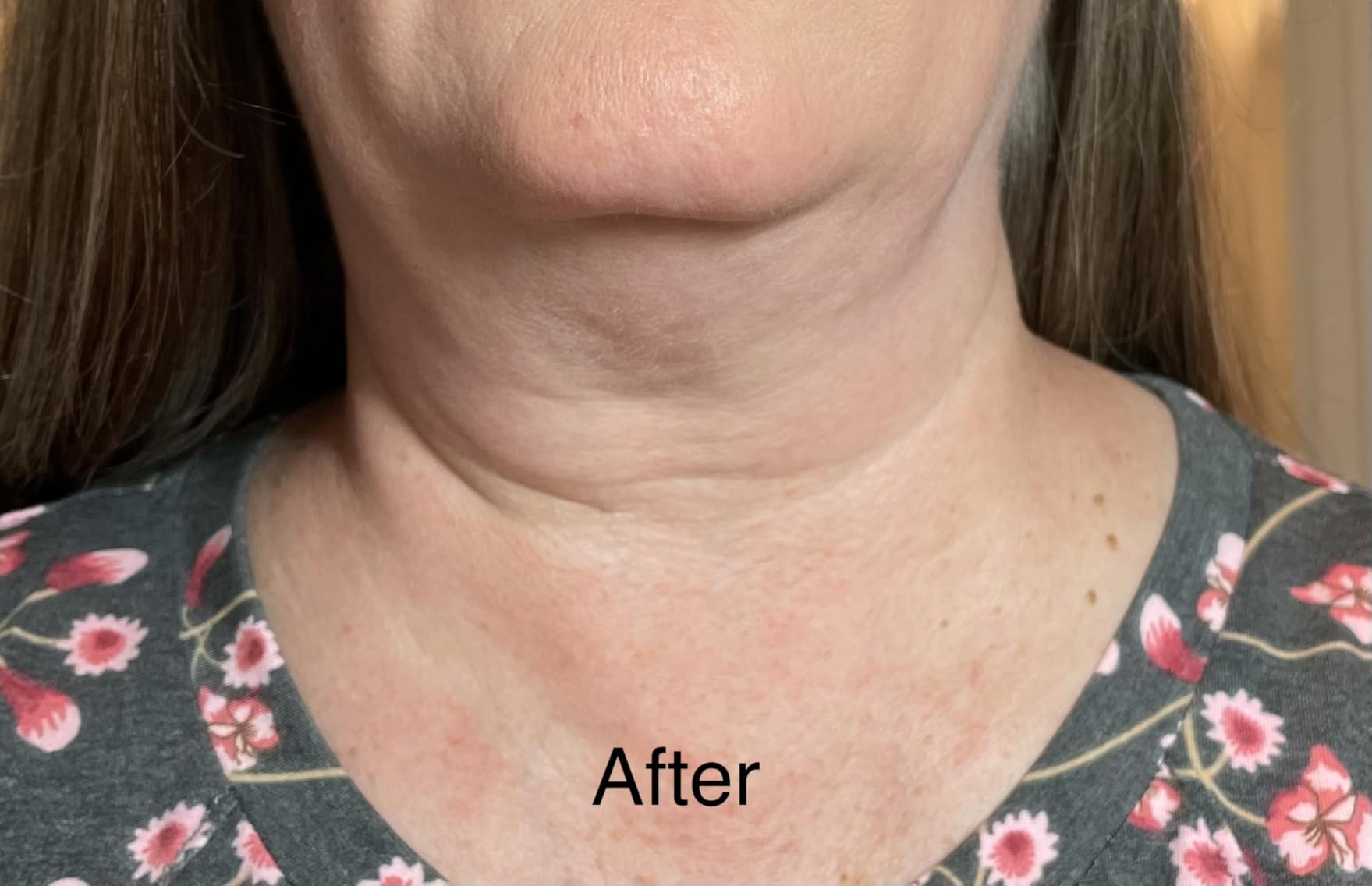 YEOUTH Neck Cream, Skin Firming Moisturizer with Vitamin C to Help Tighten and Lift the Look of Skin on Chin & Décolletage, Face and Neck Cream for Women and Men, 2oz