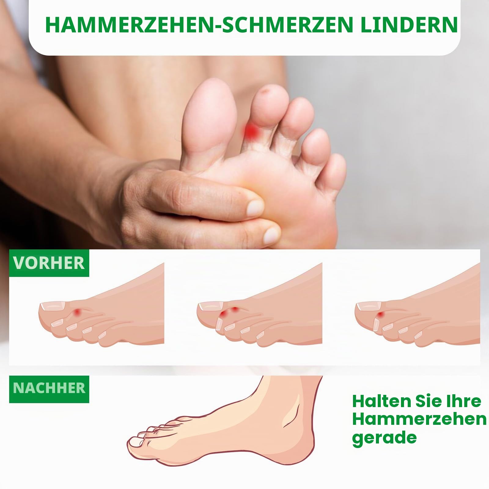 Bukihome Hammerzehen Korrektur, 6 Packs Gel Hammerzehen Schiene, Krallenzehen Korrektur, für Hammerzeh, Neuausrichtung von gebückten, schiefen, Krallenzehen (Hautfarbe, 3 Größen)