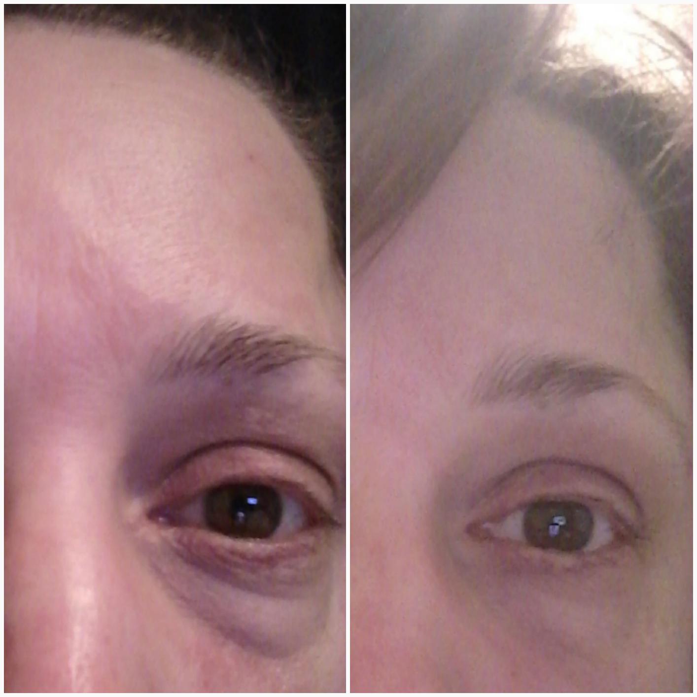 beatool Instant Ageless Eye Cream-Instantly Reduces Under Eye Bags, Wrinkles, Dark Circles, Fine Lines & Crow's Feet. Powerfully Tighten & Lifts Sagging Skin that last Hours