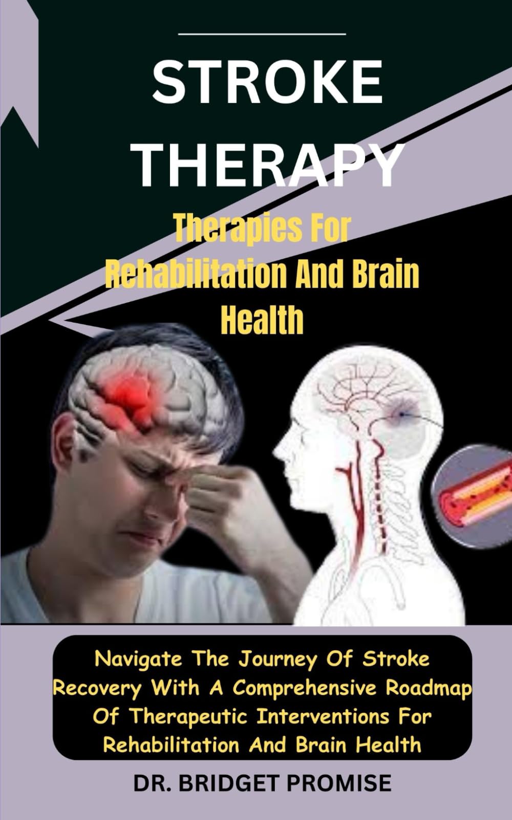 Stroke THERAPY: Therapies For Rehabilitation And Brain Health: Navigate The Journey Of Stroke Recovery With A Comprehensive Roadmap Of Therapeutic Interventions For Rehabilitation And Brain Health