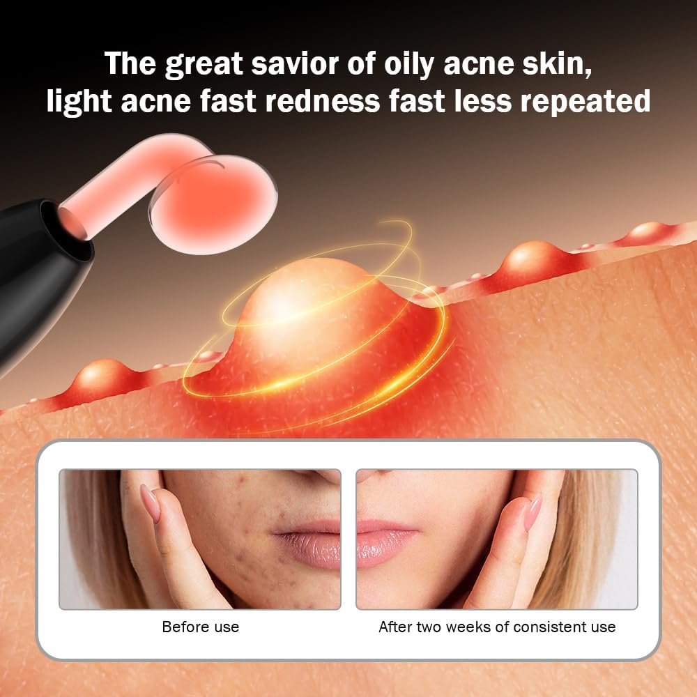 OxyGlow2 Cordless Facial Machine - ProFacial Wand Clinical Skin Therapy Wand - Neon+Argon Gas (Onyx Black) - Image 6