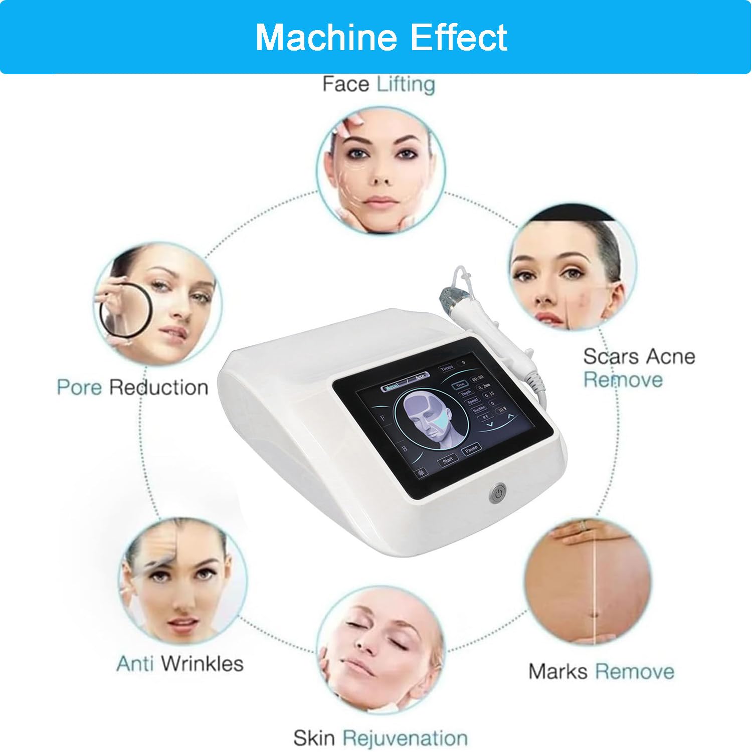 Appareil Professionnel De Micro-Aiguilletage RF,Machine De Lifting Visage 2 en 1,élimination des Cicatrices,Rides,Vergetures Et Pores Dilatés,Stimulation Collagène Usage Institut & Domestique