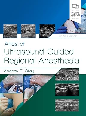 Atlas of UltrasoundGuided Regional Anesthesia: Expert Consult 