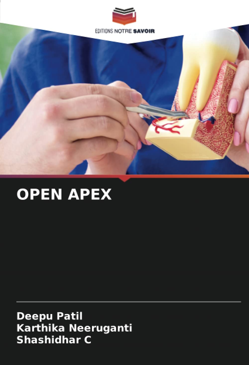 OPEN APEX