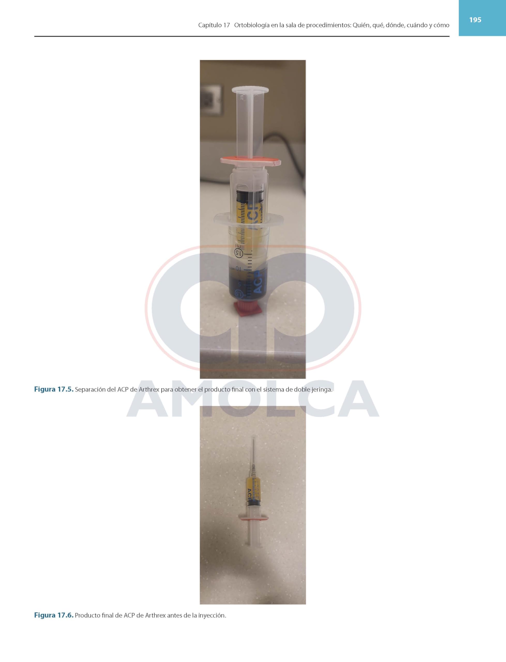 Ortobiologicos avances y aplicaciones clinicas en medicina