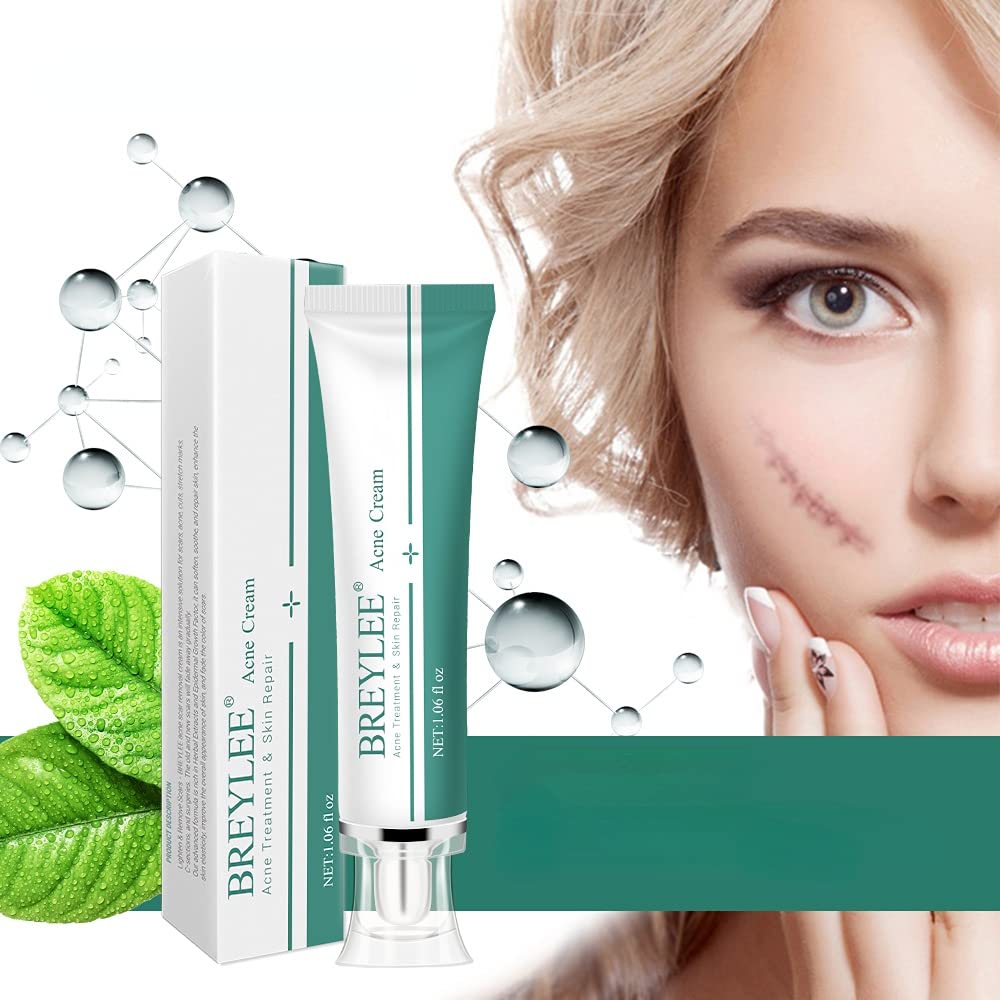 1Pcs Scar Removal Cream, Acne Scar Cream, Rapid Repair Scar Cream for Acne, Stretch Mark,Injury, Burns, Suitable for All Skin Types 30gram