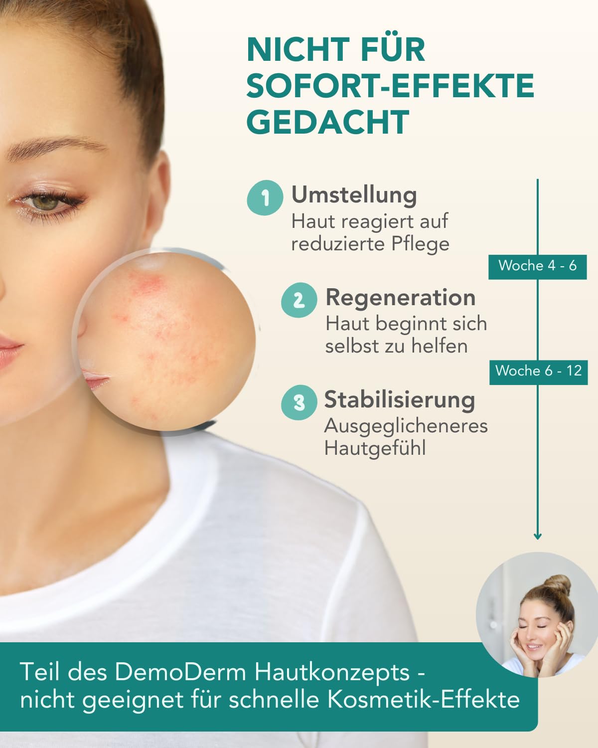 DemoDerm Rosacea Intensiv-Creme – beruhigende Systempflege bei empfindlicher, zu Rötungen neigender Haut | Mit Zink & Schwefel, Made in Germany (30 g)