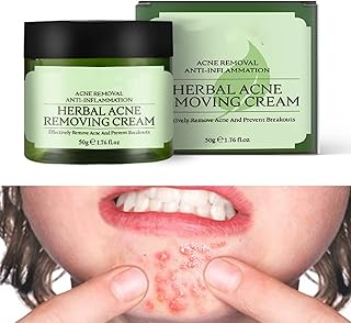 Acne Cream,Moisturiser Face Cream Spot Cream Mens Moisturiser Tea Tree Cream Spot Cream For Acne Cream Moisturiser for Women Men Teenagers Dilute Face Prone Spot Marks Balance Facial Oil Cream