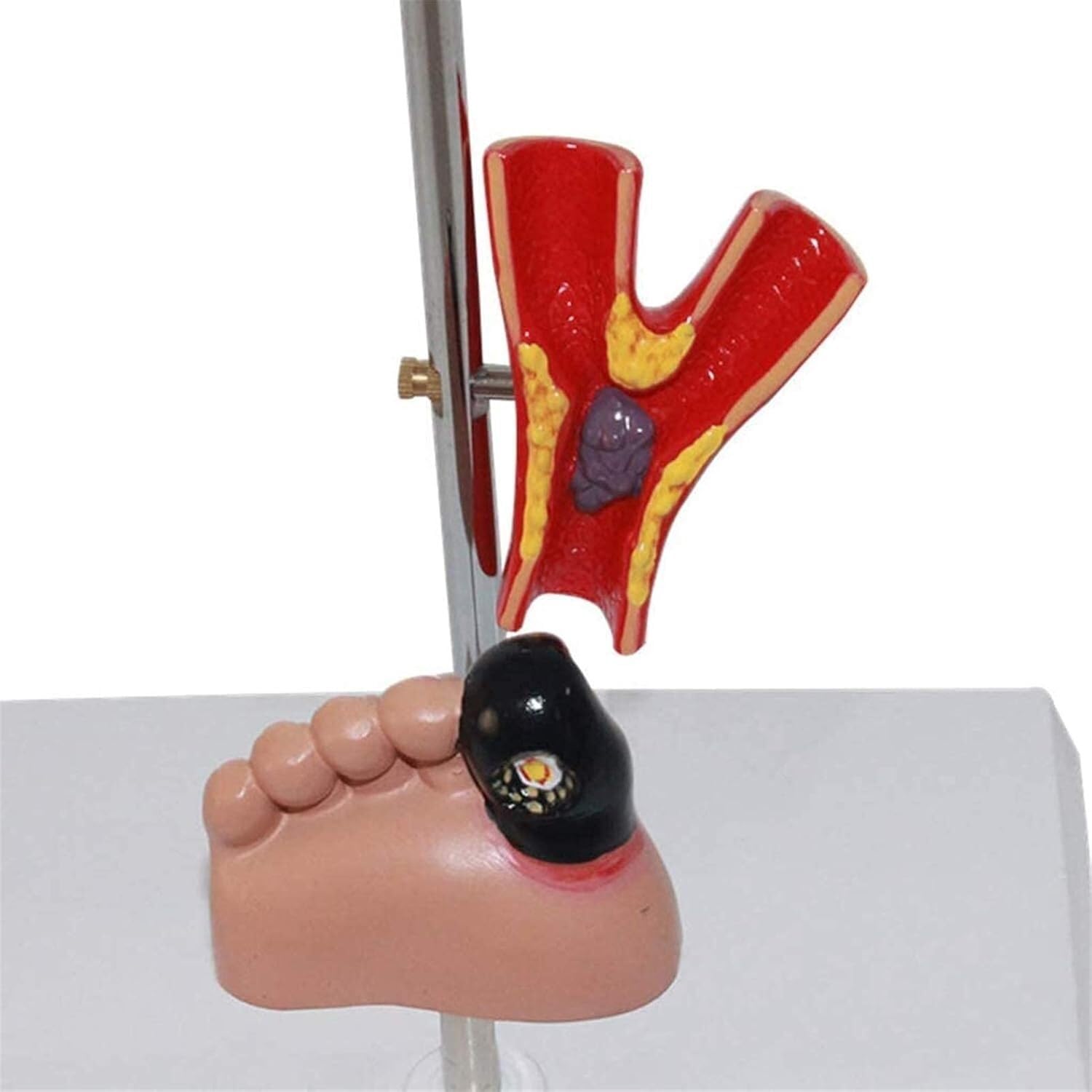 Modèle d'organe du diabète - Modèle d'anatomie médicale Modèle de diabète - Modèle Scientifique d'anatomie Humaine Amovible - for l'éducation et la Formation médicales