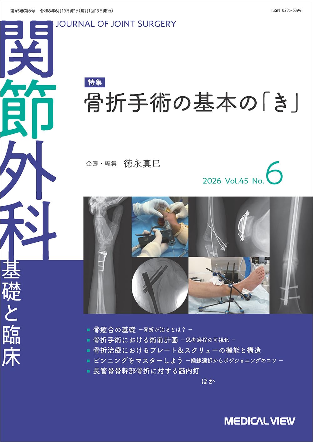 関節外科 -基礎と臨床 2026年6月号 特集：骨折手術の基本の「き
