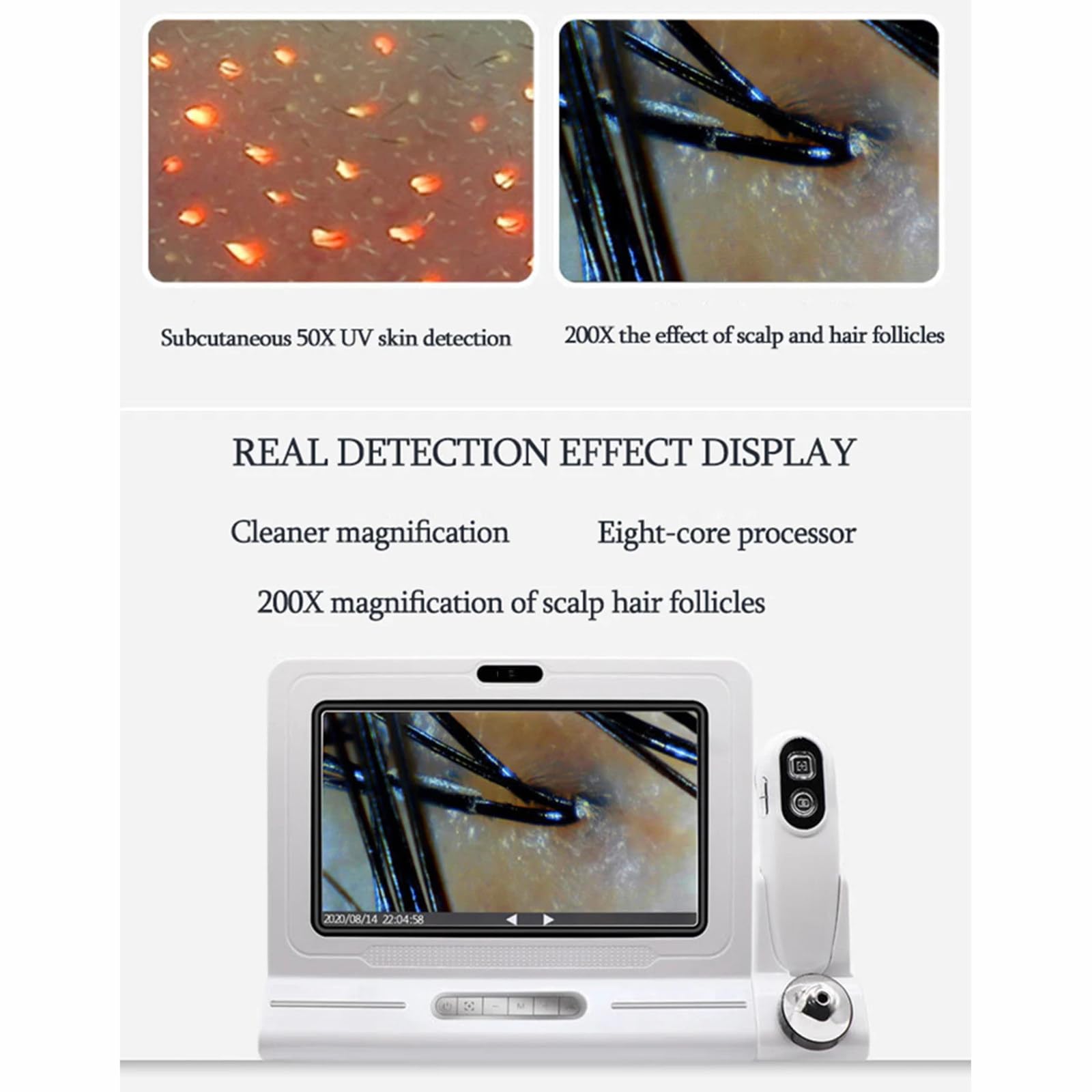Analizador de cuero cabelludo y piel LCD profesional de 11 pulgadas, Detector de microscopio Digital, lupa, Detector de cuero cabelludo y espinillas