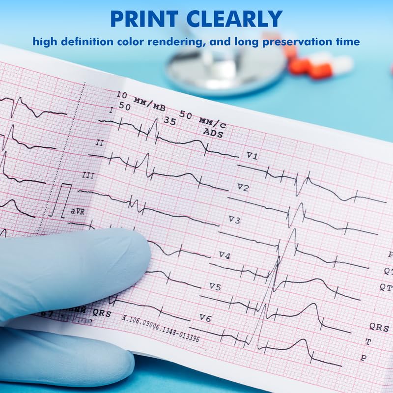 Image of OTICA ECG Thermal Paper Roll (50mm x 20mtr With Indicator) |Pack Of 10 Roll Thermal ECG Graph Paper Roll | Compatible with Standard Single /3 Channel ECG Machines