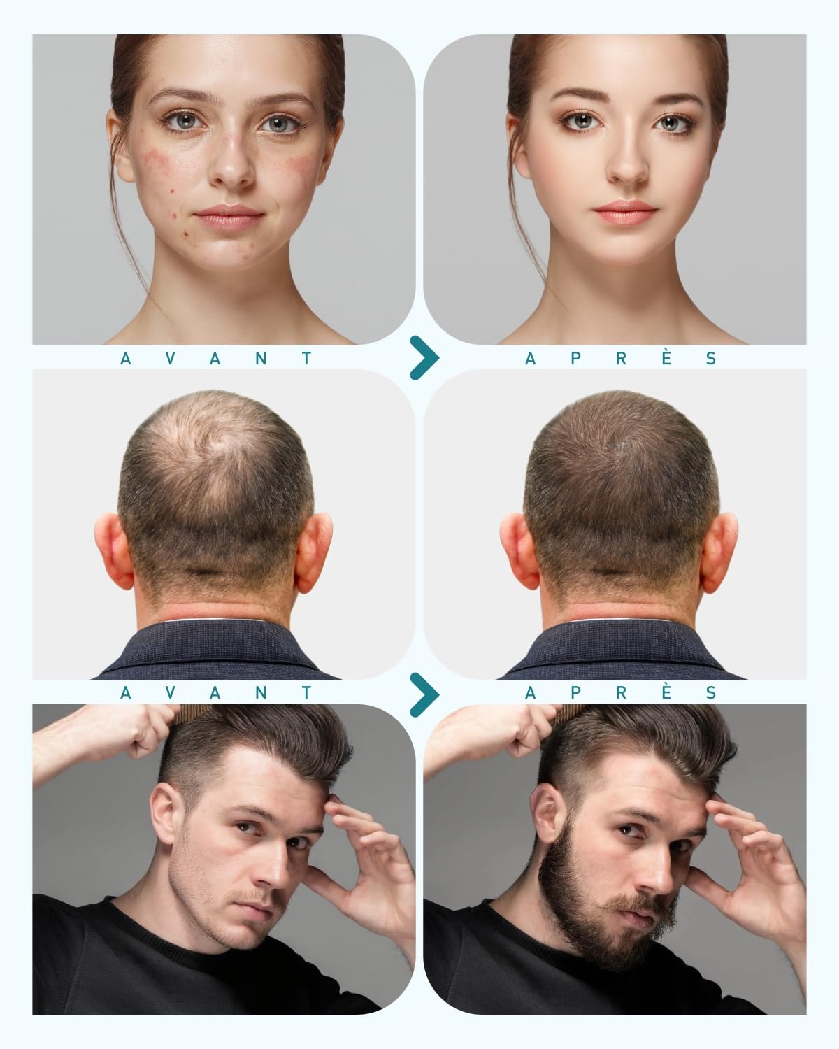 Derma Roller 0.5 mm, Kit Microneedling 10 in 1 pour le soin/massage/nettoyage de la peau, rouleau à barbe 720 aiguilles en titane, Pour les rides, les pores dilatés, les rides et les cicatrices G10