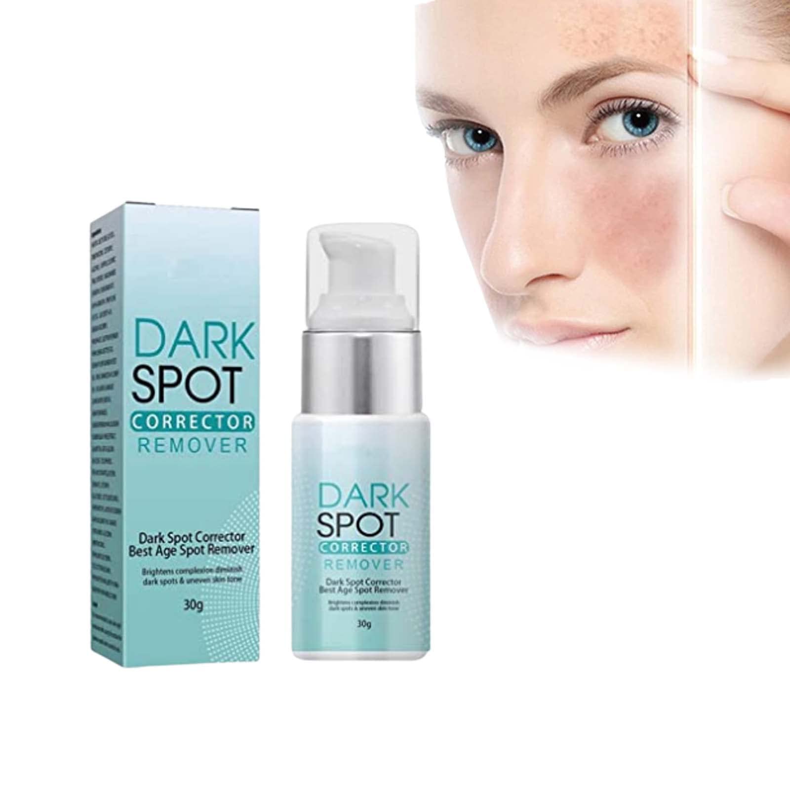 Musely For Dark Spots at Rafael Harrington blog