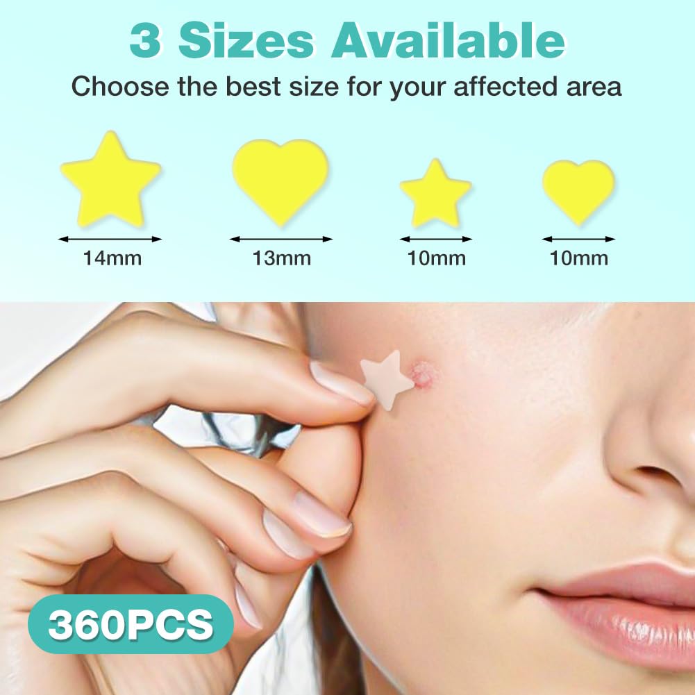 BUTBU Pimple Patches, 360 Pieces Star and Heart Hydrocolloid Spot Patch, Mighty Blemish-Patches - Image 2