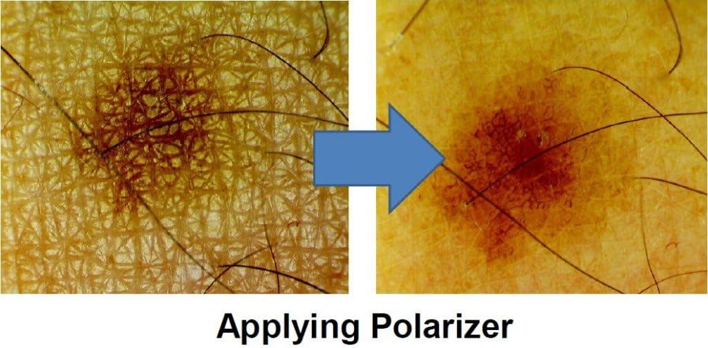 Firefly DE350 Wireless Polarized Handheld Digital Dermatoscope/Microscope for Dermatology, Trichology, and Skin Care