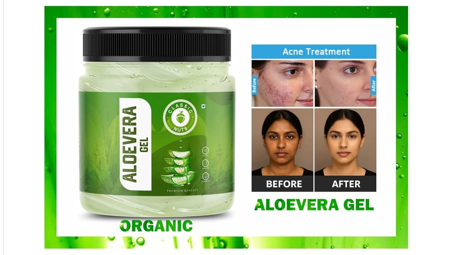 Classic Nuts Aloe Vera Gel for Face & Hair 200gm | Hydrating