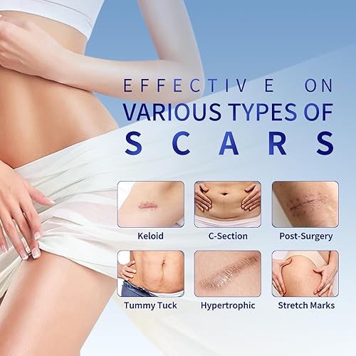 Miniatura 4 de Hojas médicas de silicona suave para cicatrices (1.6 x 59 pulgadas), eliminación de golpes queloides, rollo hidrocoloide para tratamiento de