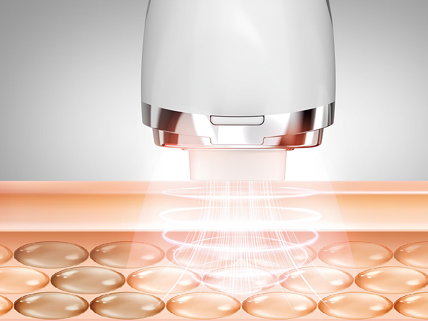 Cool-i® RF-Pflegegerät – Radiofrequenz-Technologie mit Wärmefunktion – Ergänzende Hautpflege zu Hause – Kabellos, tragbar, leicht zu bedienen