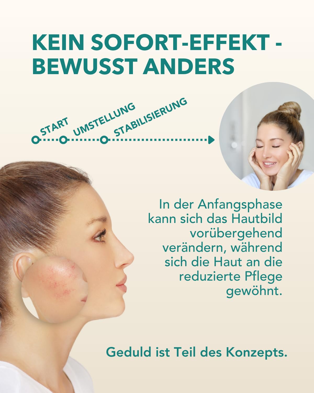 DemoDerm Rosacea Creme 30 g – wasserfreie Pflege | Für zu Rosacea neigende, empfindliche Haut | Mit Zink, Schwefel & Silber | Sehr ergiebig | Made in Germany