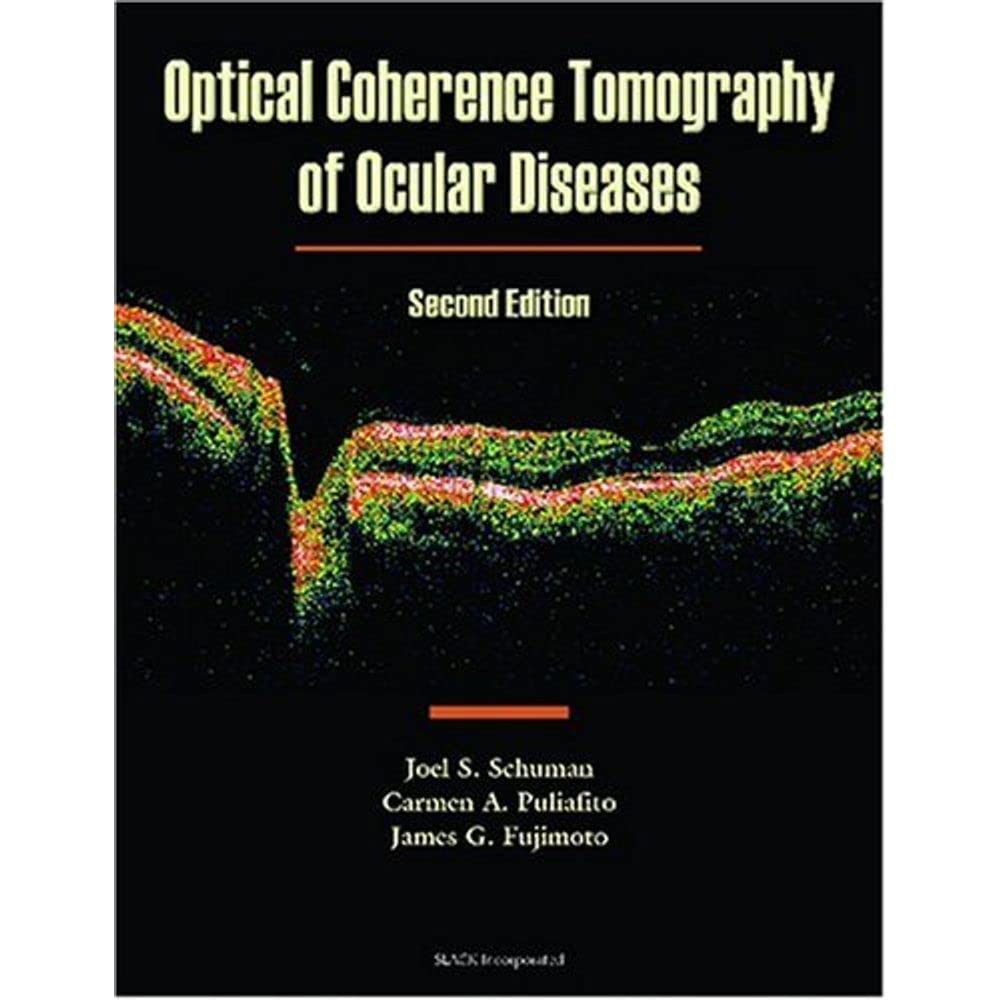 Optical Coherence Tomography of Ocular Diseases: 9781556426094 ...