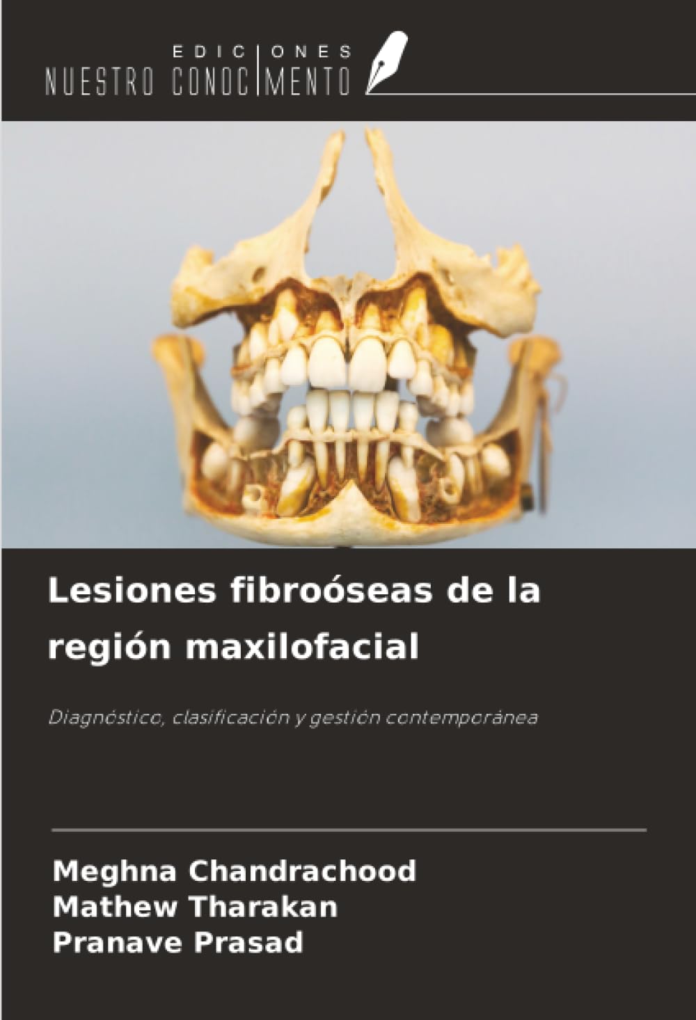 Lesiones fibroóseas de la región maxilofacial: Diagnóstico, clasificación y gestión contemporánea
