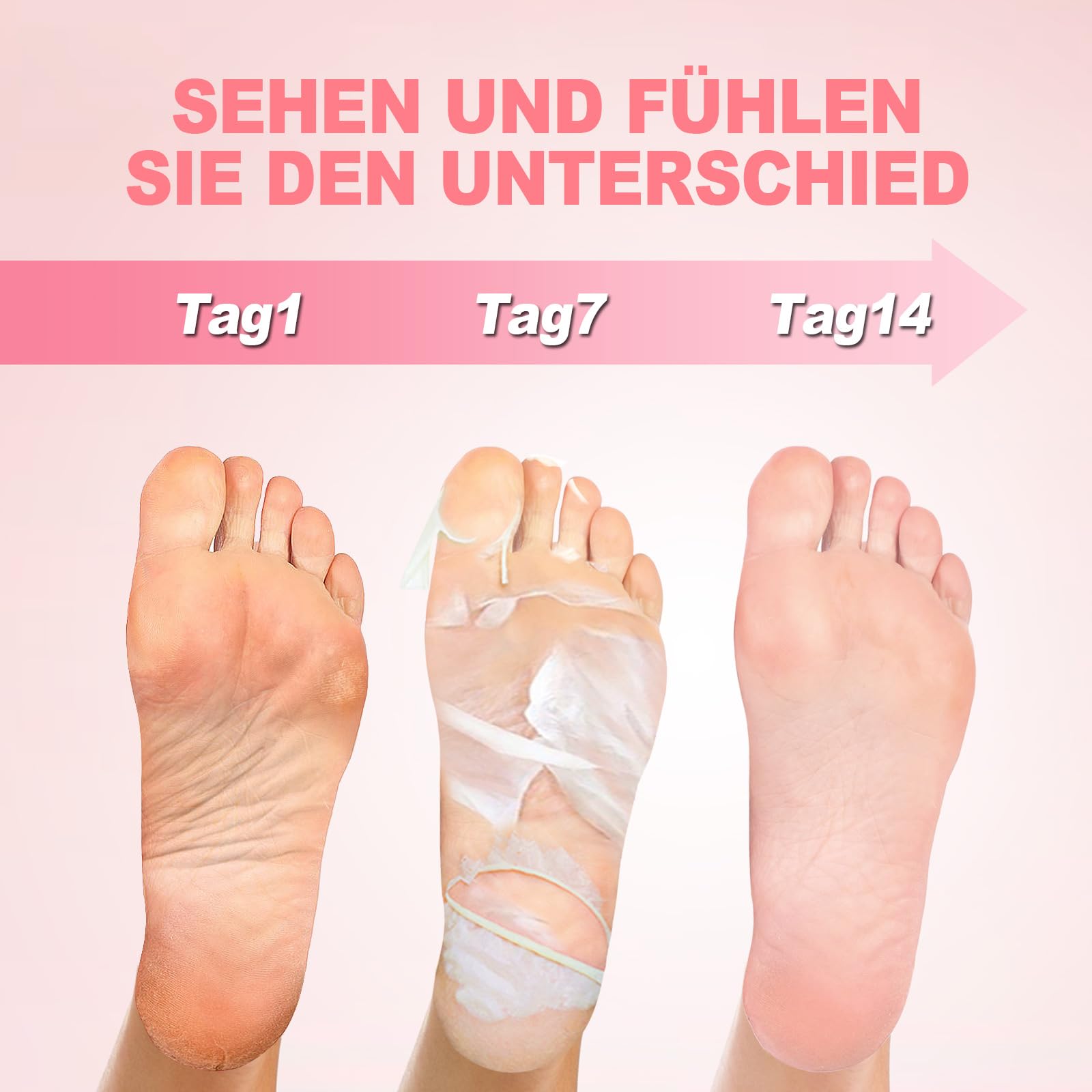 hornhaut socken gefährlich