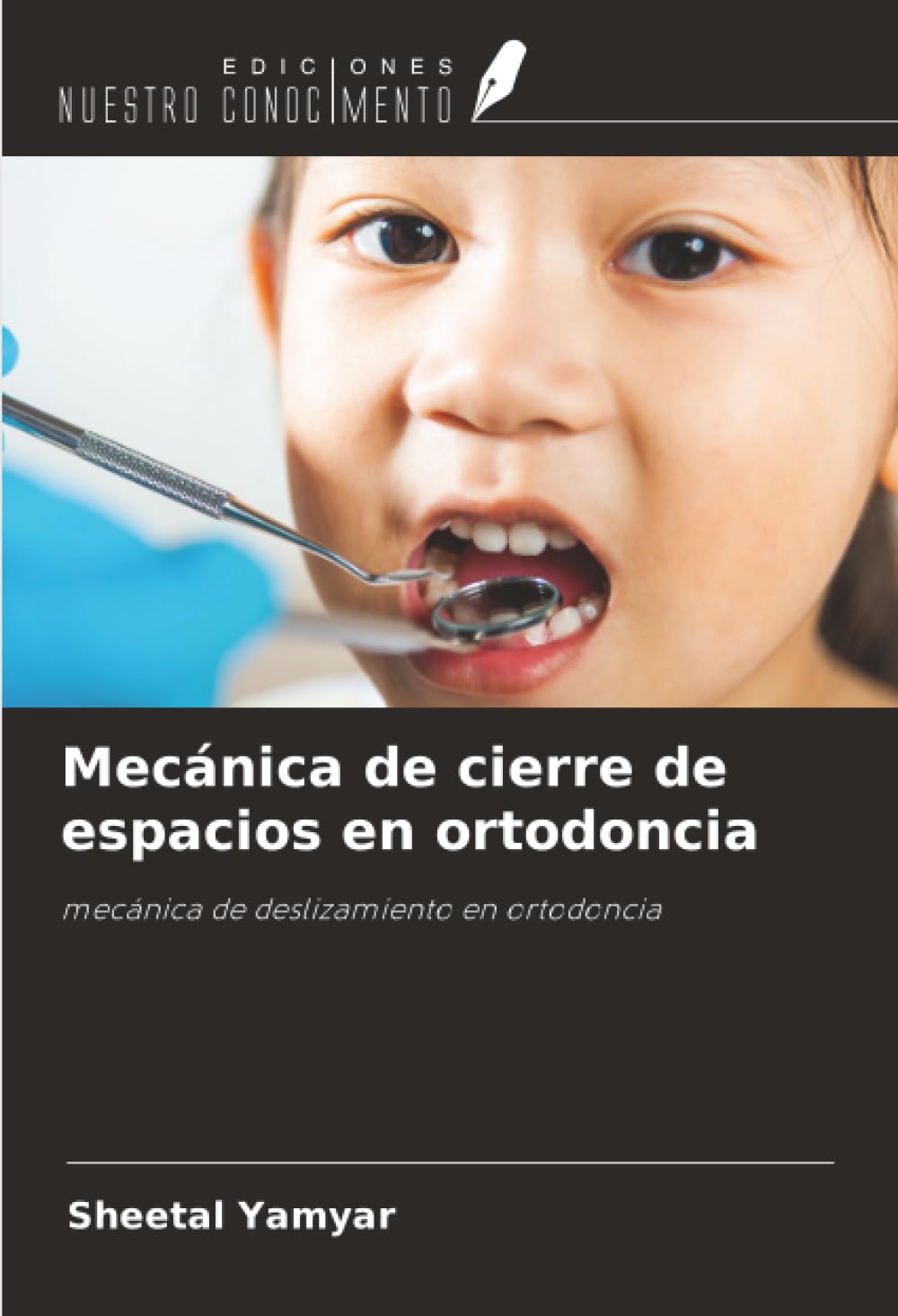 Mecánica de cierre de espacios en ortodoncia: mecánica de deslizamiento en ortodoncia