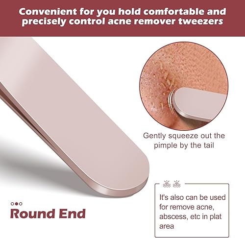 Miniatura 5 de WSYUB Pinzas profesionales para eliminar puntos negros, extractor de acné, kit de herramientas para reventar espinillas, clip para puntos blancos,