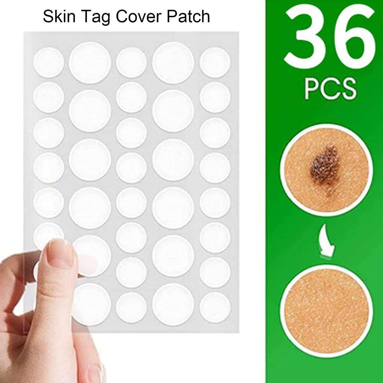 Xeerabdi Pimple Patch for Acne & Skin Tag Remover | Invisible Hydrocolloid Dots for Face | Acne & Tag Treatment for Women, Girls | Skin Tag Cover Patches (36 Pcs) (5) 1