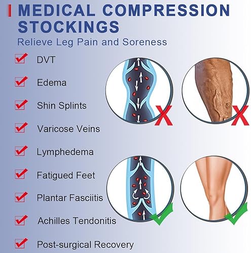 Miniatura 5 de Beister Mangas de compresión sin pies hasta el muslo con banda de silicona para mujeres y hombres, firme 20-30 mmHg soporte graduado