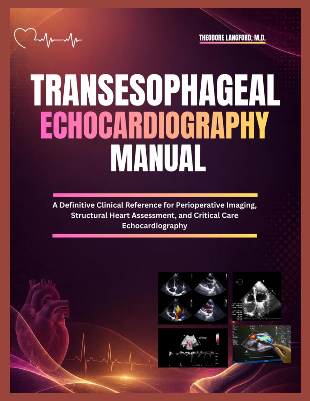 Transesophageal Echocardiography Manual: A Definitive Clinical Reference for Perioperative Imaging, Structural Heart Assessment, and Critical Care Echocardiography