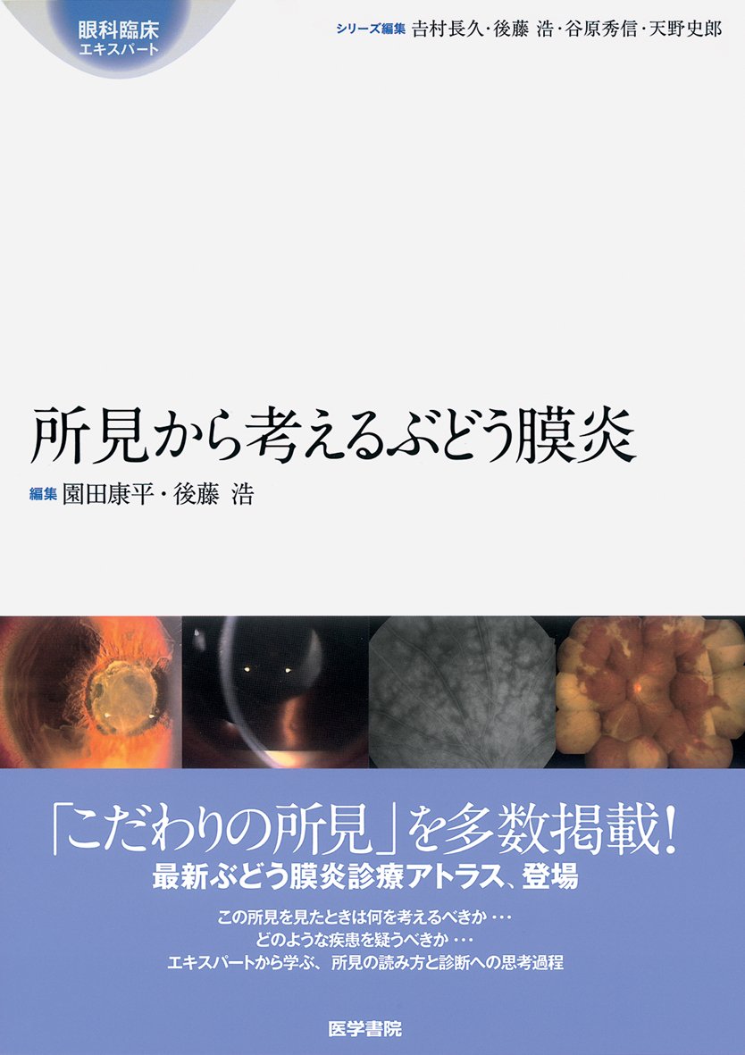 Amazon.co.jp: 所見から考えるぶどう膜炎 (眼科臨床エキスパート 