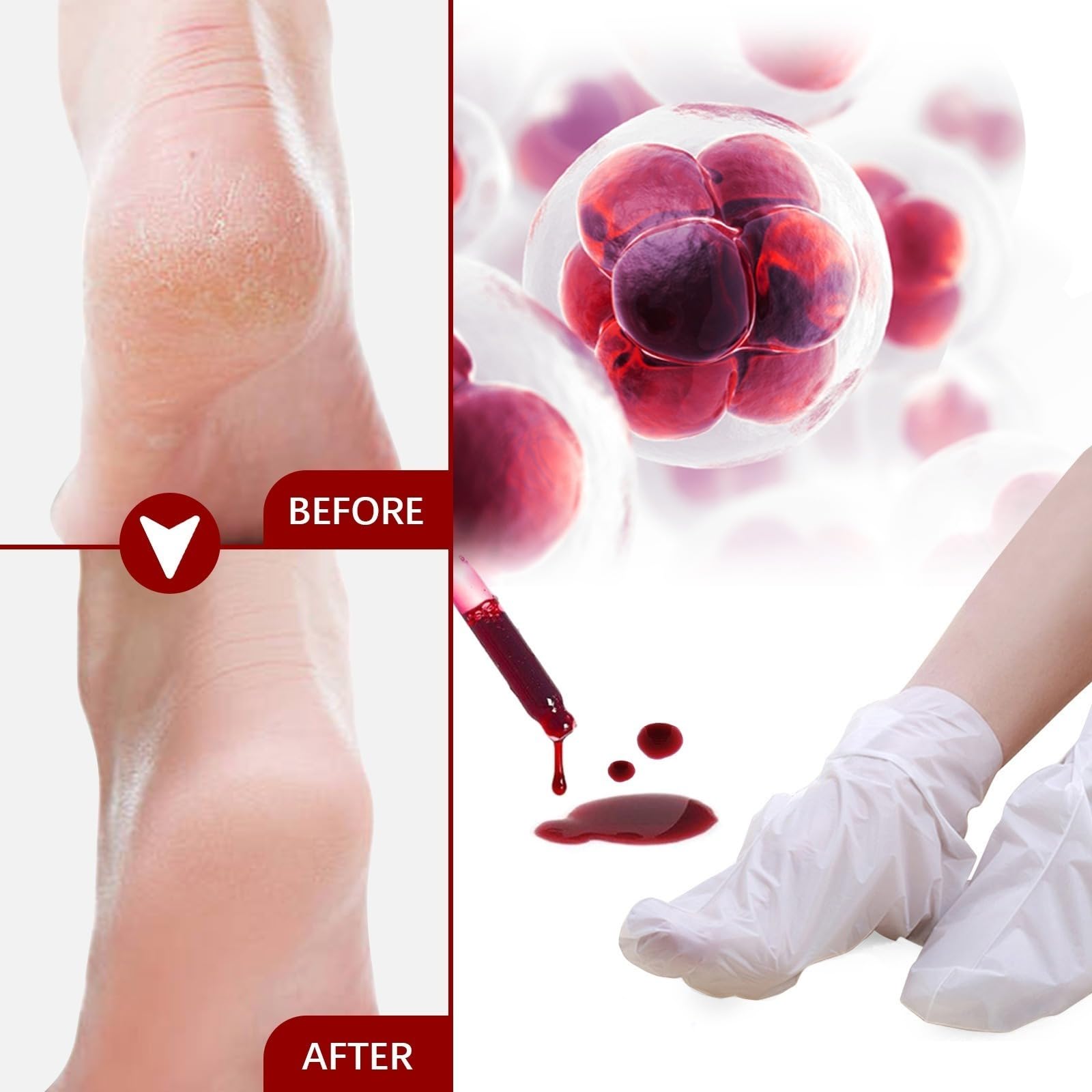 Máscara de pie para peeling de melocotón, máscara de pies hidratante con nueces de coco- Cuidado de callos y pieles muertas - Pie Hidratante, exfoliante, callo peeling pies