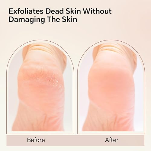 Miniatura 5 de Lima de pie de nanocristal, removedor de callos de pies, herramientas de pedicura de doble cara para pies, doble uso de seco y húmedo, limpiador