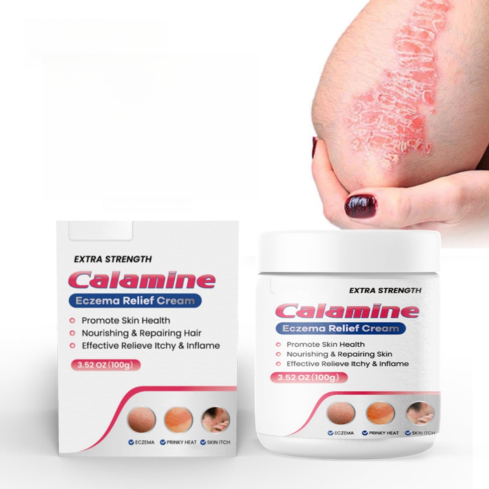 Eczema Relief Cream, 100g Healing Skin Care Cream for Eczema, Relieves Itching, Dryness, Scaling, Soothes Irritated Skin, Ideal for Foot & Hand Dermatitis, Moisturizes & Repairs Skin Barrier