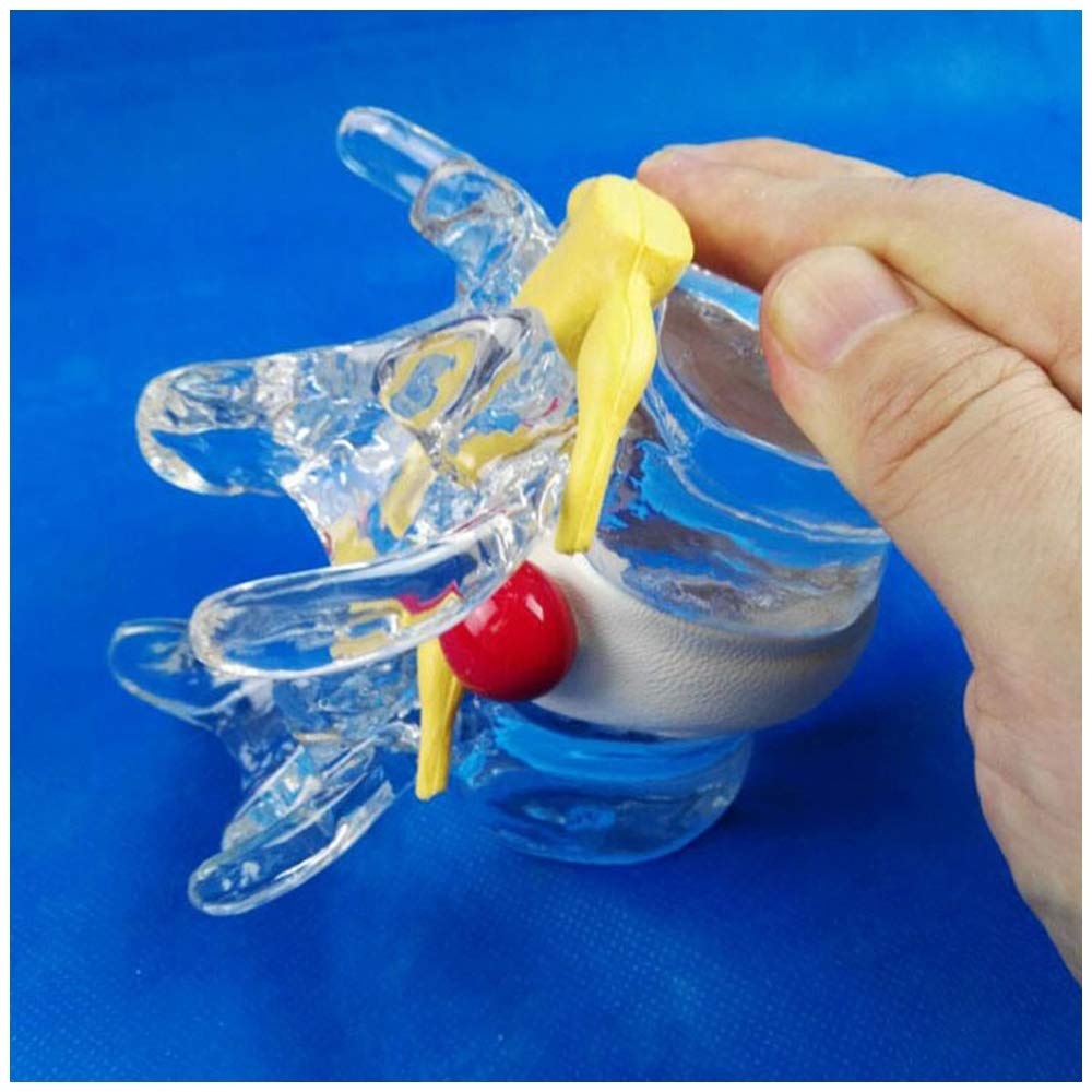 sjdoPulse Spinal And Spinal Cord Extrusion Model - Medical Anatomical Human Spine Model Medical Teaching Model Demonstration Model - for Medical Educational Traning Aid