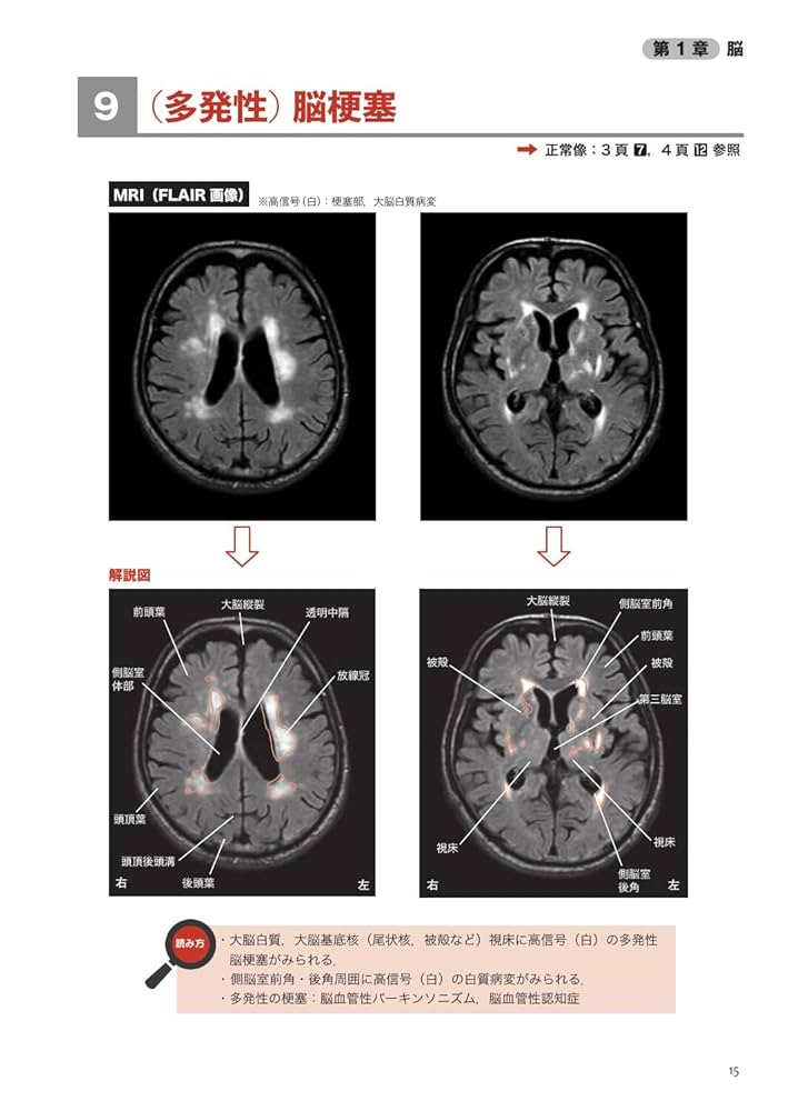 理学療法士・作業療法士 PT・OT基礎から学ぶ画像の読み方第4版